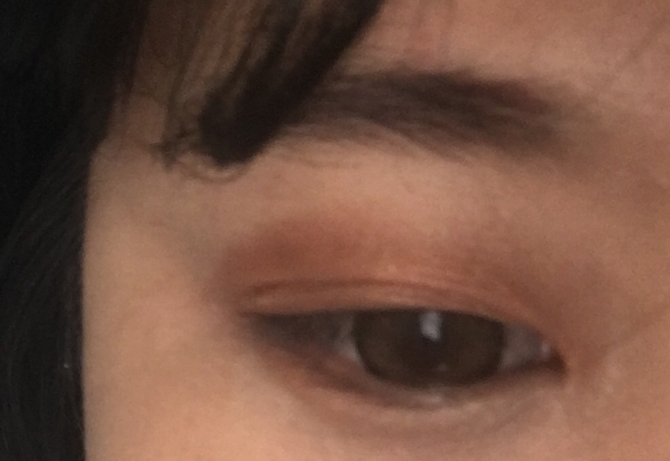 눈을 게슴츠레 떠도 원래 내 쌍커풀이다 처럼 됩니다! 