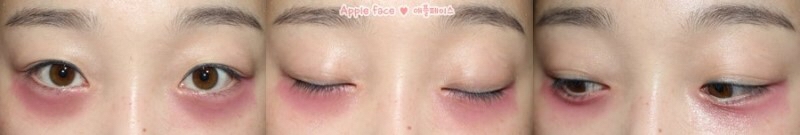  
니베아 립밤으로 눈밑에
다크써클부분을 쓰윽- 발라줬어요~
촉촉하니 부드럽게 잘발려서
눈밑에 부담을 주지 않아서 좋아요