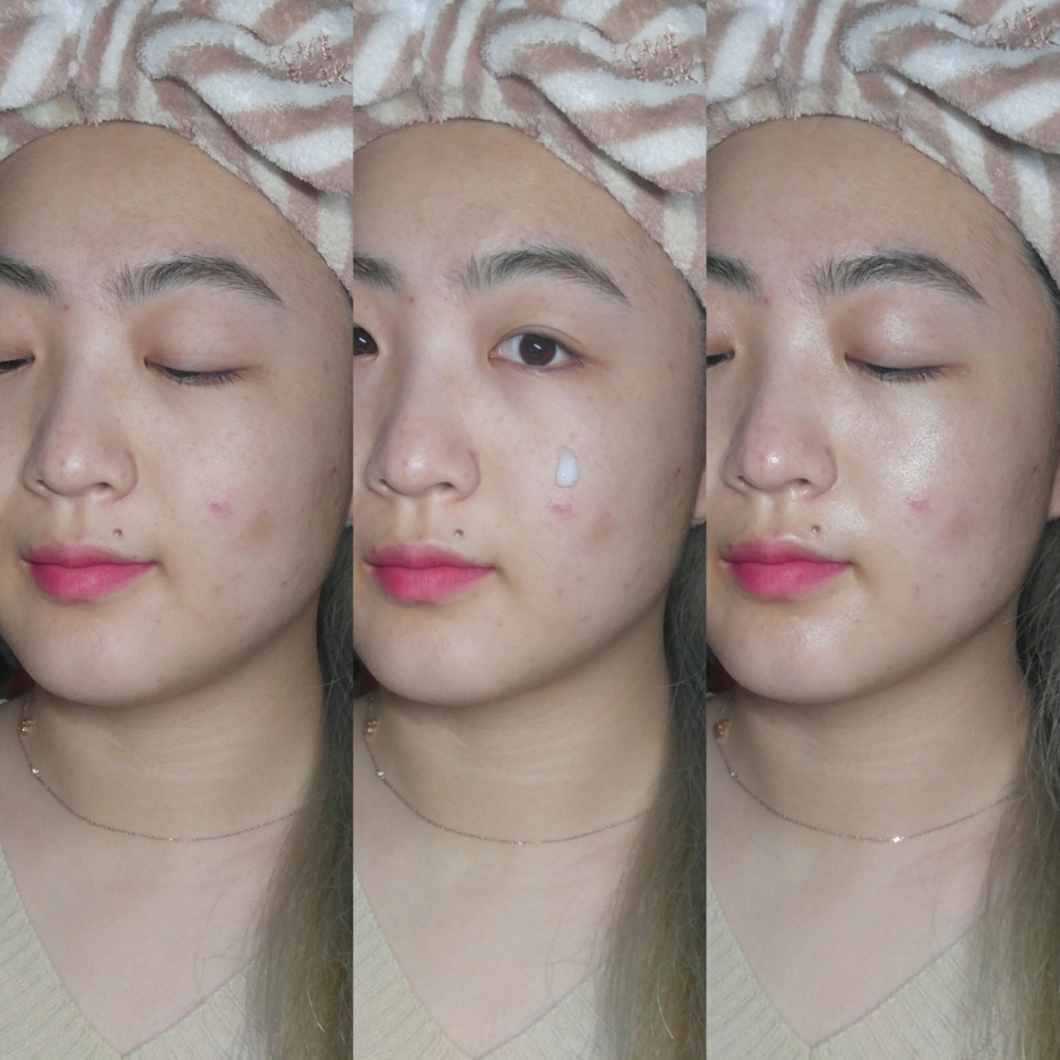 그 중에서도 #슈퍼 모이스쳐 브라이트닝 LED 크림은

#루꼴라추출물 함유로 뛰어난 항산화와 미백 효과를 갖춘 기능성 크림이라고 할 수 있어요😁♥
-
사용감은
.
🎆 LED 전용 크림답게, 단시간 내에 빠르고 확실한 흡수력을 보여줌
🎆 아주 촉촉하면서 부드러운 발림성
🎆 물보다도 빠르게 피부에 스며들어, 사용감은 피부 속이 부들부들 모찌모찌해진 것 같은 느낌!
🎆 역시 LED마스크와 함께 사용하니, 일반 크림 사용 시보다 효과가 더 극대화되는 느낌!
🎆 왜냐하면, 마스크 사용 후에도 흡수가 느려 번들거리고 잔여감 있는 다른 크림들과는 달리!
LED 전용 크림은 피부 속에 효과적이고 빠르게 침투•흡수되기 때문에,  마스크 사용 후 크림이 밀리는 듯한 번들거림이나 잔여감 없이 깔끔했기 때문이다👍