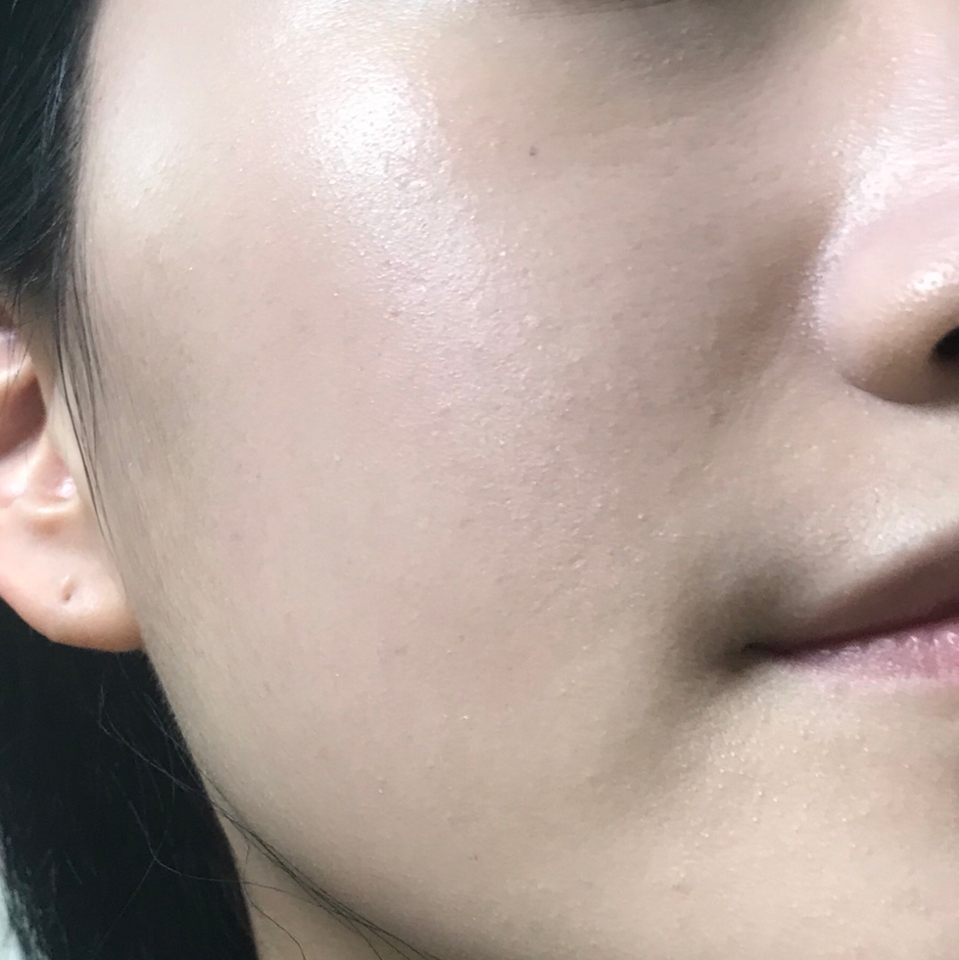 픽서를 바른 뒤 파운데이션을 바른 모습입니다☺️
이게 어떤 느낌이냐면 픽서가 정말 파운데이션을 짱짱하게 잡고 있는 느낌⁉️ 

픽서 사용이 이번이 처음인데 스타트를 정말 좋은 제품으로 끊었네요 정말 마음에 듭니다😭

건조한 제 피부에도 건조함이 심하다라는 느낌 못받았구요 기초를 짱짱하게 해주니까 적당히 세미메트한 느낌의 피부가 완성되었어요🌸

자잘한 모공을 메워줌으로써 도자기같은 피부 표현이 가능했답니다 픽서 진짜 짱...💗