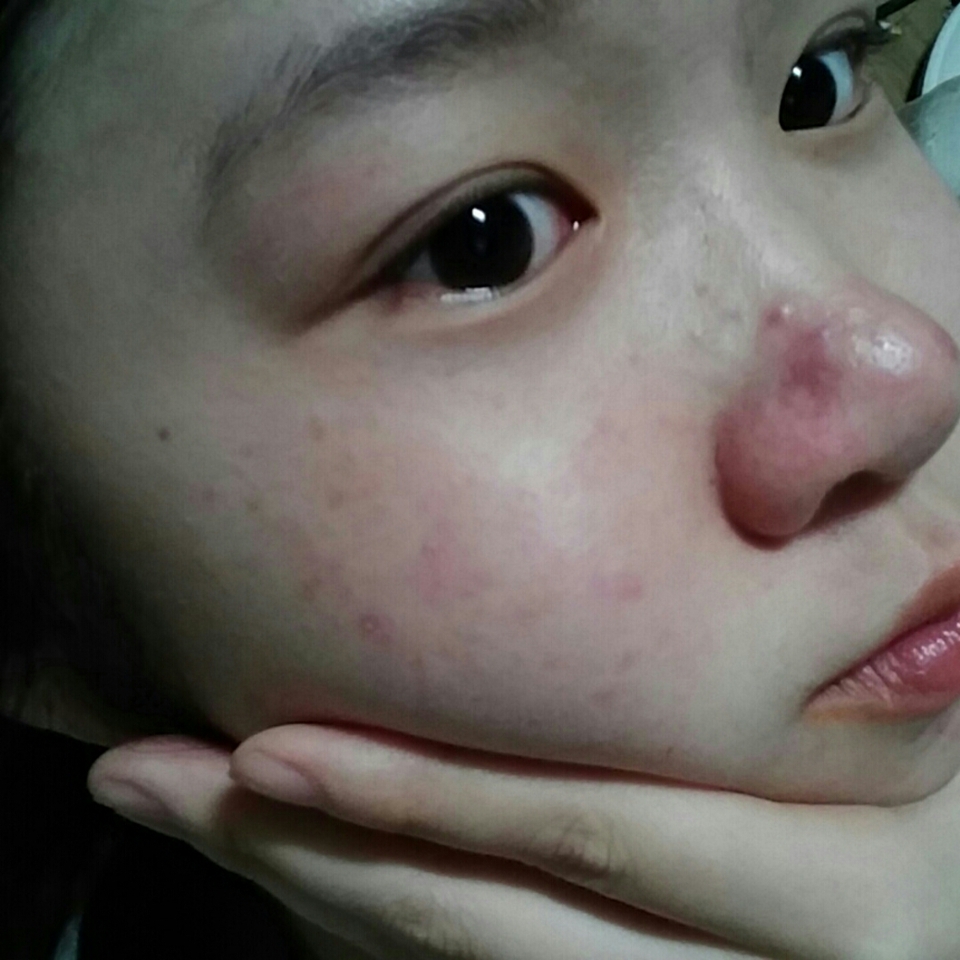 먼저 현재 각질과 호르몬 분비로 인해 너저분한 현재 제 피부 상태 입니다...
요즘 진짜 스트레스 받아요ㅜㅜㅜㅜ
그러니 이제 이 피부를 서서히 바꿔봅시다..!