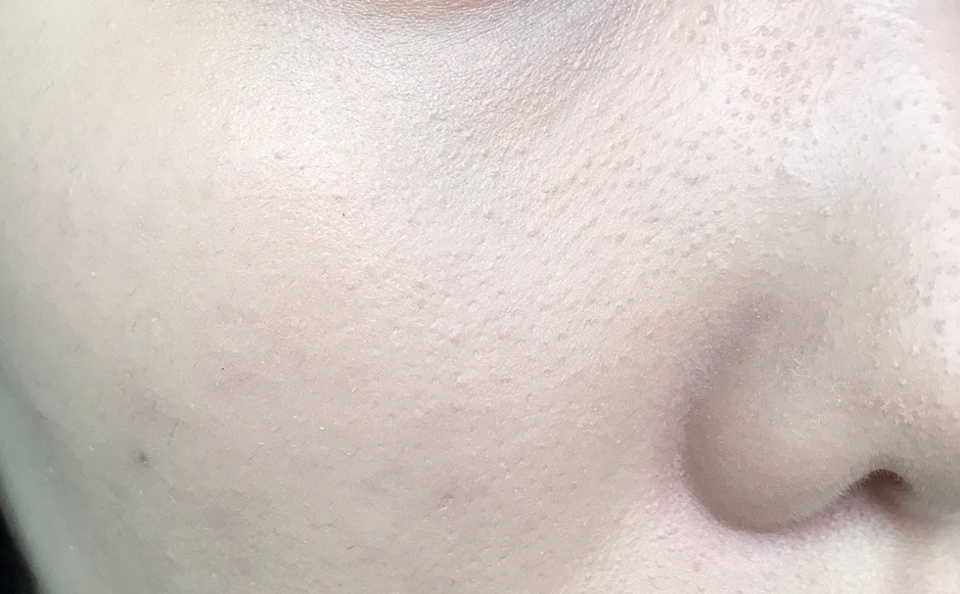 파운데이션만 바른 상태입니다 볼이 비어서 매우 허전하죠ㅠㅠ
