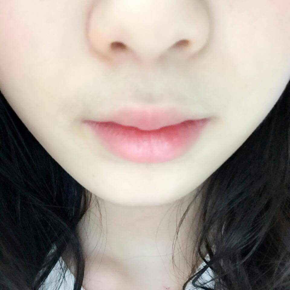 립밤바른 아파보이는 입술 준비