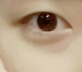 무쌍눈2