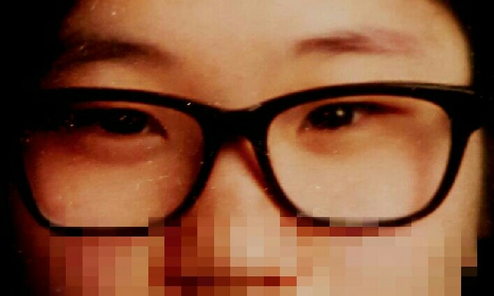 이것도중학교  안경쓰면 그나마 눈이커보이는
