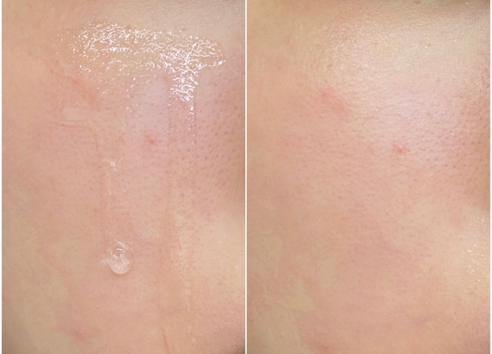 앰플을 적당량을 짜서 발라준 다음 손으로 얼굴을 감싸 흡수시켜주세요
아주 약간의 점성이 있는 제품인데도 흡수가 잘 되고 마무리가 촉촉해서 속당김이 없었어요!

[꿀팁 정리]

✨최소한의 스킨케어만! 
-가벼운 제형의 앰플 또는 세럼 추천

✨속보습이 제대로 되고 마무리감은 촉촉한 제품

✨손으로 얼굴을 감싸서 끝까지 흡수시키기


