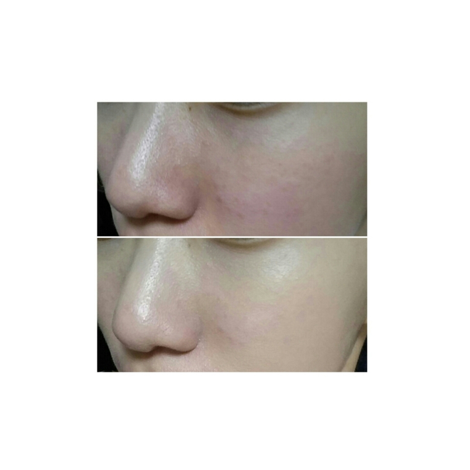 사진 약혐 주의)) 부담스럽길래 사진 크기 줄였어용...밝기조절도 하지 않은 생 원본입니다..!