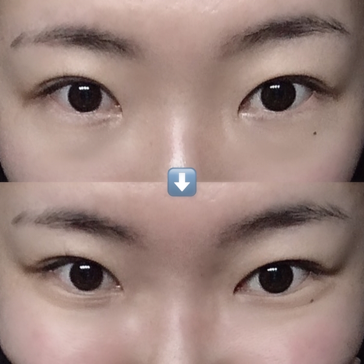 두번째 방법,
양 볼을 위로 올리면 조런 라인이 생겨요!! 



둘 중 편한 방법을 선택하시면 됩니당ㅎㅎ