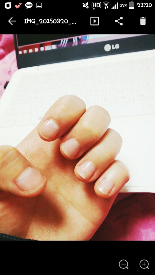 ㅋㅋㅋ앞에 사진을 찍은 뒤 무려 2주나 참고 기른 사진이에요.ㅋㅋㅋㅋㅋㅋㅋㅠㅠㅠㅠ진짜 물어뜯고싶고 자르고싶고 그런거 꾹 참고 길렀어요ㅠㅠㅠ 그래도 짧고 지저분하네요...