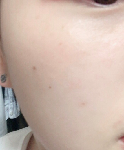 클렌징을 해본결과 깨끗하게 닦여요 자극도 없고 부드러워서 좋구 클렌징폼 사용하기전에 패드로 닦고 해서 편해서 더 좋았던거 같아요 
이상 꼼둘이의 솔직한 파워 리뷰 였습니다 