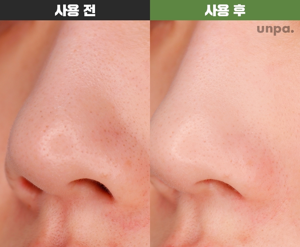 클레어스 클렌징 오일은
가장 많은 블랙헤드가 있는
오른쪽 콧볼을 중심으로 사용해봤어

오돌토돌한 피지가 정리되면서
피부가 한결 매끈해진 느낌!