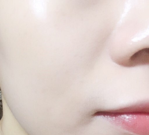 ​

다 바른 후인데 생각보다 과하지않은 광채죠? 비교적 커버력도 있었어요.

붉은 잡티들도 들뜸없이 잘 커버가됐어요. 무엇보다 베이스가 답답하지않아서 맘에 들었어용!