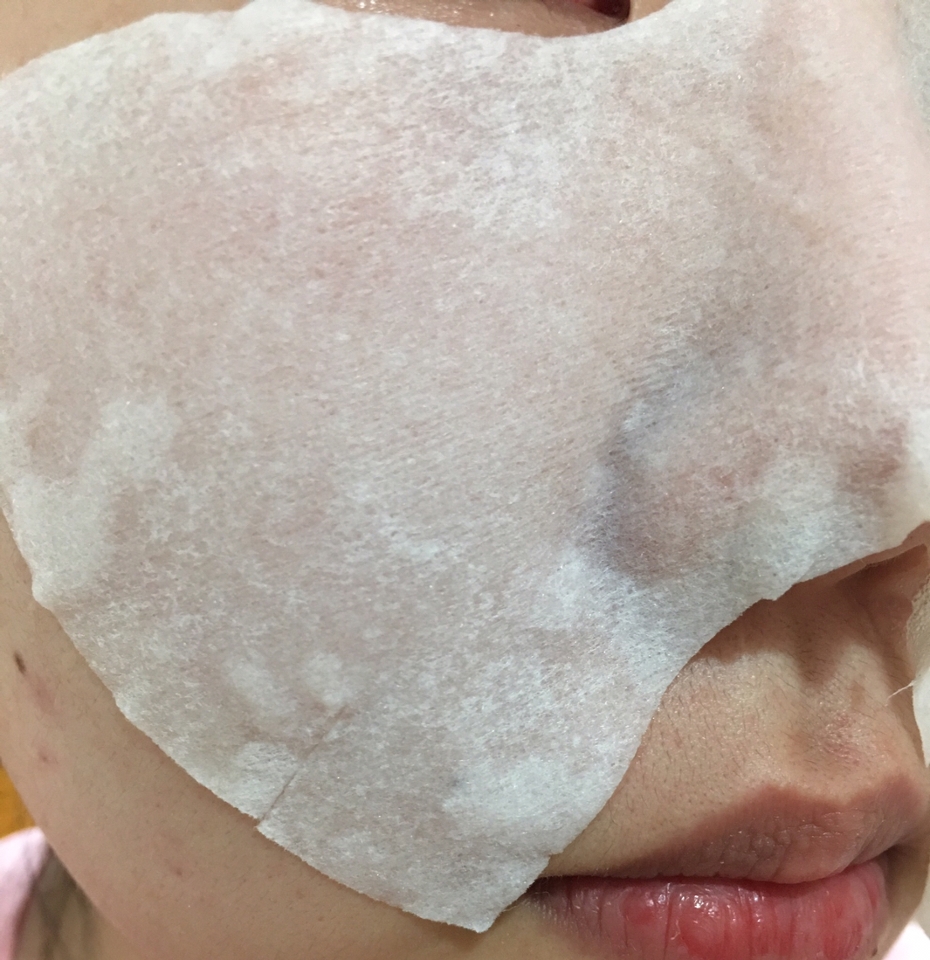 떼어내기 전, 얼굴에 붙이고 20분이 다 되어갔을때 다시한번 더 찍어봤어요 탄산이 많이 빠졌어요 