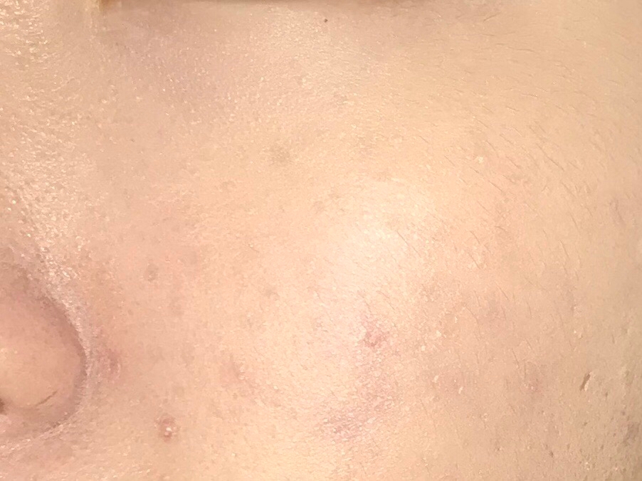 제 생각보다 너무 촥촥 잘 발려서 좋았어요!
하지만,코 옆 같은 세세한 부분은 잘 안발려서 아쉬웠어요ㅜㅜ 
그래서 일반 쿠션퍼프로 마무리해줘야 화장이 예쁘게 더 밀착되는 것 같더라고요!
