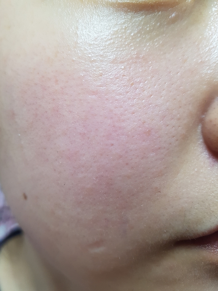 붉은끼 가득한 민낯에 기초까지 마친 상태에요!