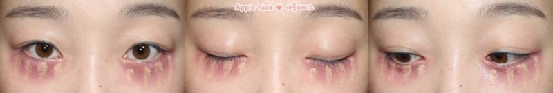 컨실러로 콕콕콕 찍어주고~
저는 에어쿠션을 이용하여 퍼트려 줬어요!
​자세한 방법은 동영상을
참고해 주세요 ​