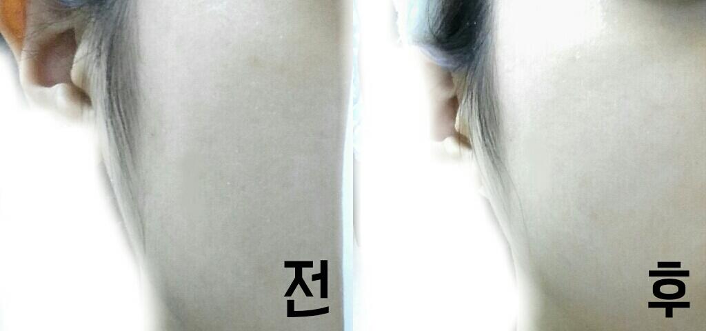 ❗여기서 중요한게 식염수는 코세척용, 멸균생리식염수로 사야되는데
렌즈세척용 식염수는 방부제가 들어가 있어서 절대 안됩니다!
화장솜도 보통 화장솜보다 3겹,5겹 압축 화장솜을 이용하셔야 좋은데
보통화장솜을 쓰시면 화장솜이 두꺼워서 식염수를 먹는다고 하네