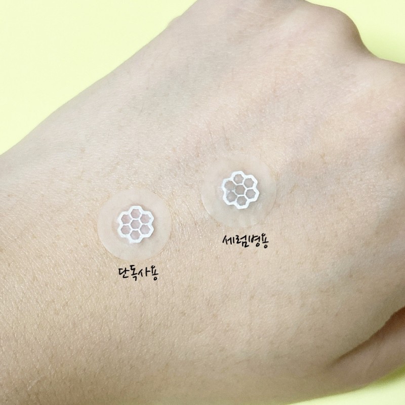 제품을 손등에 먼저 사용해 봤습니다.

제품은 여드름 연고 또는 여드름 앰플 등과 병용해서 사용할 수 있어요.

니들케어 가운데에 소량 연고나 앰플을 덜어 문제 부위에 부착하면 됩니다.

니들케어의 가운데 니들이 깔때기 모양이기 때문에 앰플이나 연고가 피부에 더욱 빠르고 효과적으로 스며들 수 있도록 도와준다고 하네요.

앰플이나 연고의 양이 너무 많으면 패치 밖으로 내용물이 넘쳐 나와 그 주변이 지저분해지니 아주 소량 사용하도록 합니다.

소량이라도 니들로 인해 피부 깊숙이 유효성분이 전달된다고 하네요.

아, 혹시 니들로 인해 사용 시 아프지 않나 하는 걱정이 있을 수 있는데요, 직접 사용해 본 결과 아주 살짝 따끔??할 정도이지 아프진 않았어요. 따끔한 정도는 실핀으로 살을 살짝 찌르는 정도??

제품 사용 시 겁먹지 않아도 됩니다. ㅎㅎ