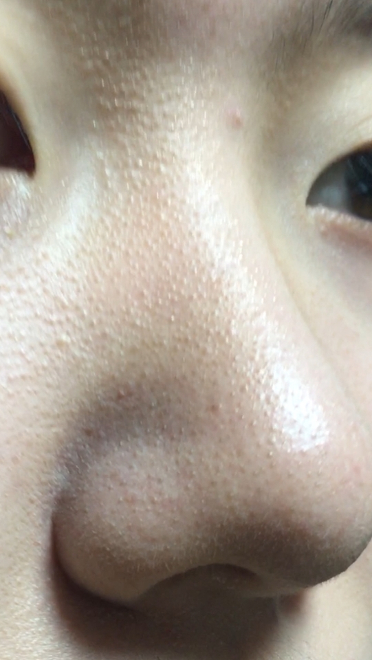 이렇게 요철부각이 된다고 해야하나요?ㅠㅠㅠㅠ 블랙헤드랑 모공은  어쩔수없는건지..
화장할때 글로우온베이스>모공프라이머>미백크림>파데>픽서>파우더>파우더쉐딩 하이라이터 하는데 피부도 저렇게 텁텁하게 부각되고 쉐딩도 너무 거뭇거뭇하고 피부 요철 도드라지게 하는 것 같아요😭
조금이라도 매끈하고 뽀송하게 표현할 수 없을까요ㅠㅠㅠㅠ오히려 화장하면 더 피부가 나빠보이네요