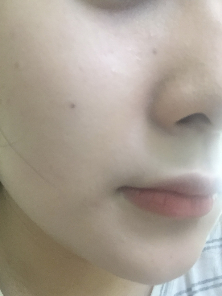 점이 많은 제 오른쪽 뺨이예용. 커버력은 없고 하얗게 톤보정이 되어용
