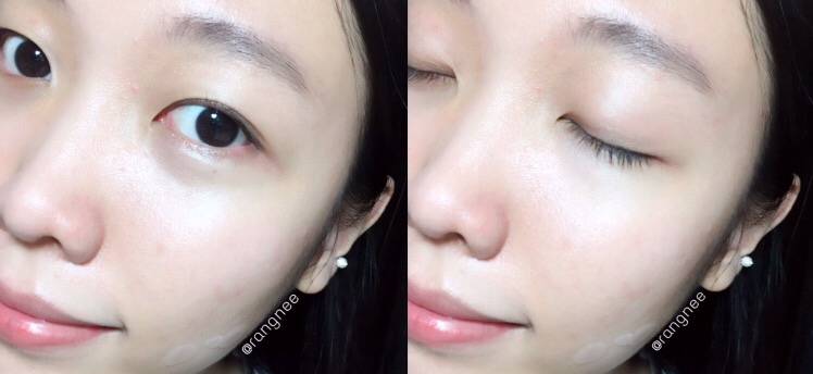 그럴 때 요거로 몇번 닦아주니까 기름부자인 제 피부의
유분감도 사라지고 산뜻하게 밸런스있는 상태를 유지해
줘서 트러블을 예방하고 완화시키는 데 효과적이었어요!

얼마간 사용하다보니 뒤집어졌던 피부도 차츰 되돌아와서 얼마나 감격스럽던지 ㅠㅠ