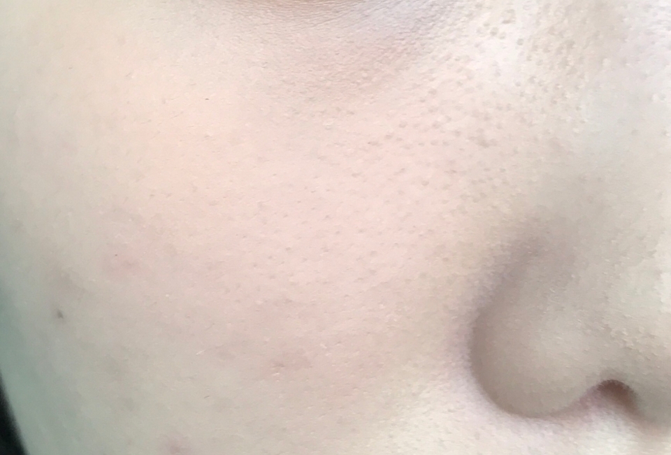 색감 잘 잡히라고 진하게 올렸는데 이정도ㅠㅠ 멀리서 보시면 더 잘 보이실 거에요... 전후랑 왔다갔다하면서 볼 보면 후 사진이 더 살구살구해요!