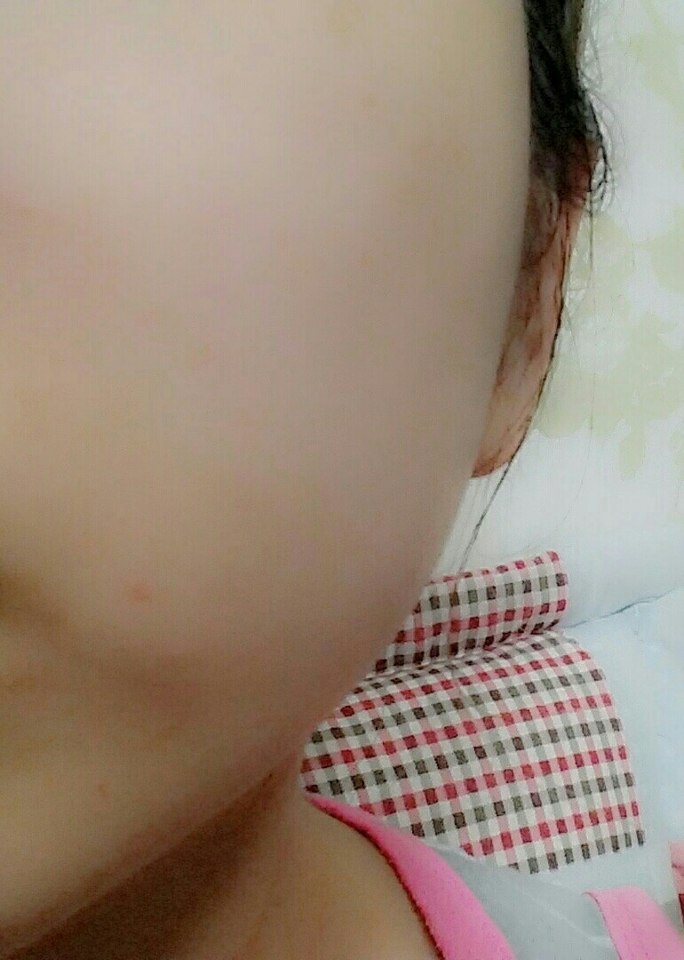 사용 후!
모공피지각질 3중케어가 가능한 제품이라는데, 세안하고 나면 개운한 기분이 들어요. 추천해드립니다!