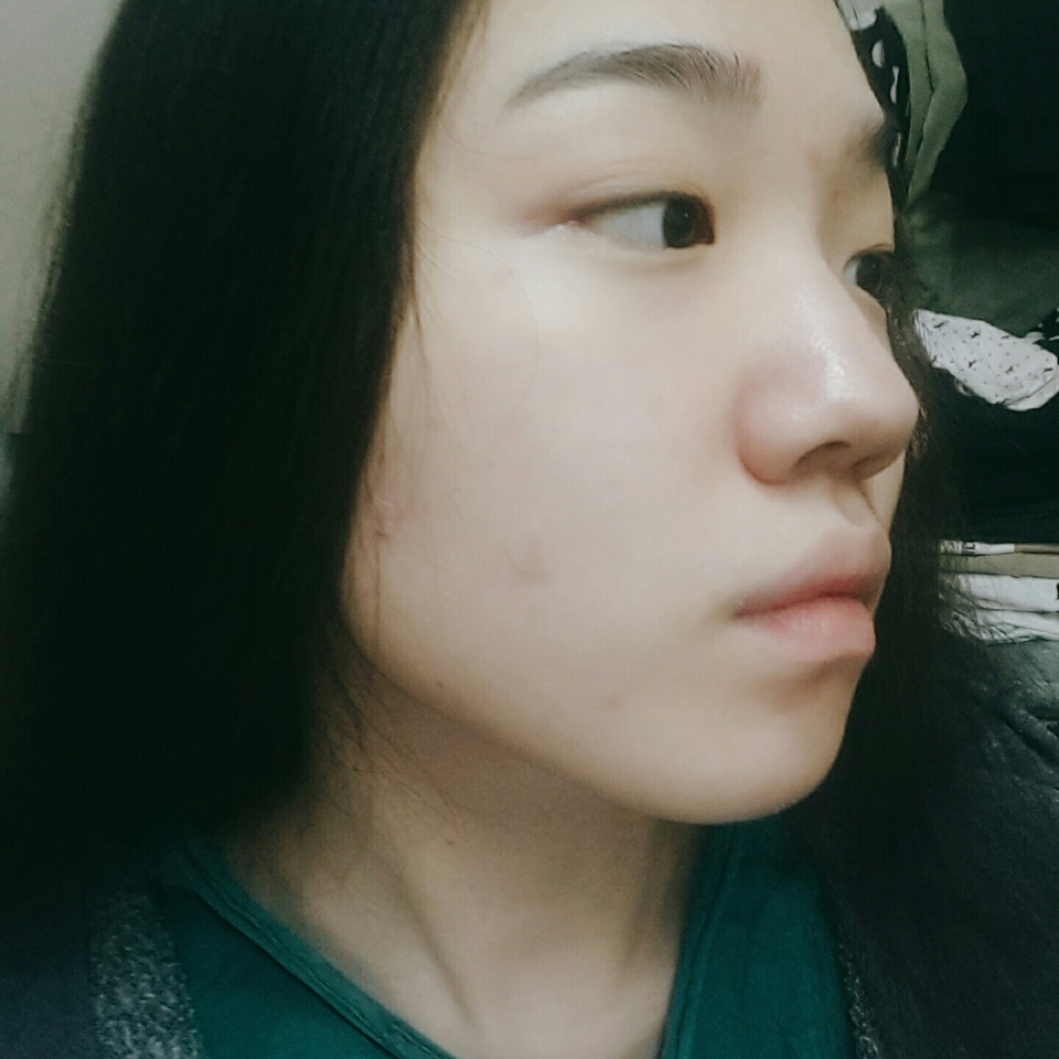 요즘 트러블 때문에 자국 나고 피부도 거칠어요ㅠ