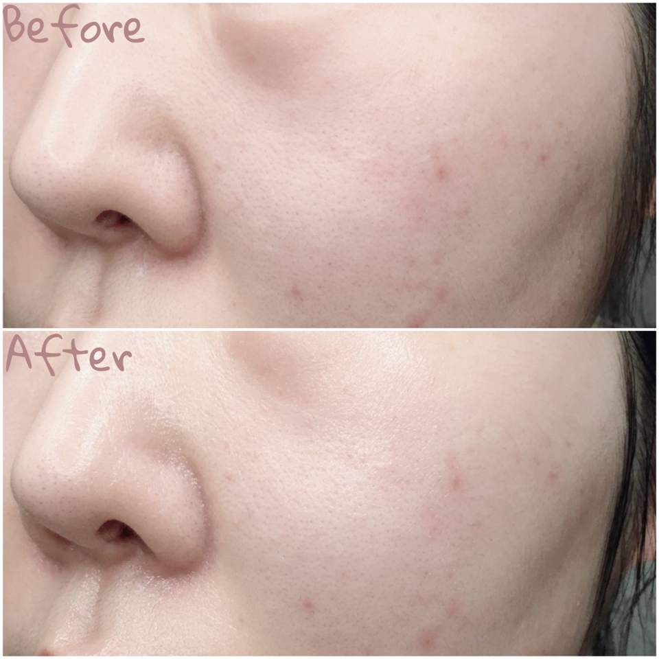 부드럽게 잘 펴발라지는데 피부에 바르는 즉시 영양과 보습을 채워주는 느낌이 들었고 끈적임이 조금도 느껴지지 않았어요

보습력이 좋은 고영양 크림이라 피부가 많이 건조한 건성 분들한테 아주 잘 맞을것 같아요
다른거 안바르고 토너 사용 후 이 크림 하나만 발라줘도 유,수분이 부족으로 인한 건조함을 해소할 수 있었고 깊은 보습력으로 장시간 촉촉하게 유지할 수 있었답니다

이 크림 하나만으로도 풍부한 영양과 수분 공급은 물론 보습, 활력, 생기, 미백, 주름 개선까지 도움이 된다니 건강한 피부를 위해 꾸준히 사용해봐야겠어요