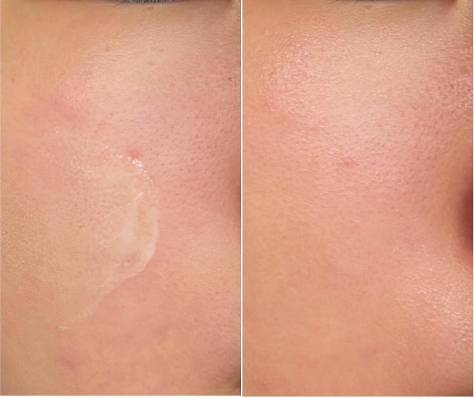 가볍고 부담없이 바를 수 있는 제품이라 특히 여름에 정말 애용하고있어요 
보통 이런 제형의 선크림은 번들거림이 있는 경우가 많은데 이건 흡수가 잘 되니 금방 보송해지더라구요 제품명 그대로 산뜻한 느낌이었어요!

[꿀팁 정리]

✨촉촉하고 흡수가 잘 되는 선크림 추천
-약간 묽은 제형

✨양쪽 볼, 이마, 코, 턱에 덜어서 바르기

✨얼굴 바깥쪽에서 안쪽으로 바르며 솜털 사이사이까지 흡수시켜주기
-마지막에 안쪽에서 바깥쪽으로 문지르며 피부결 정리해주기