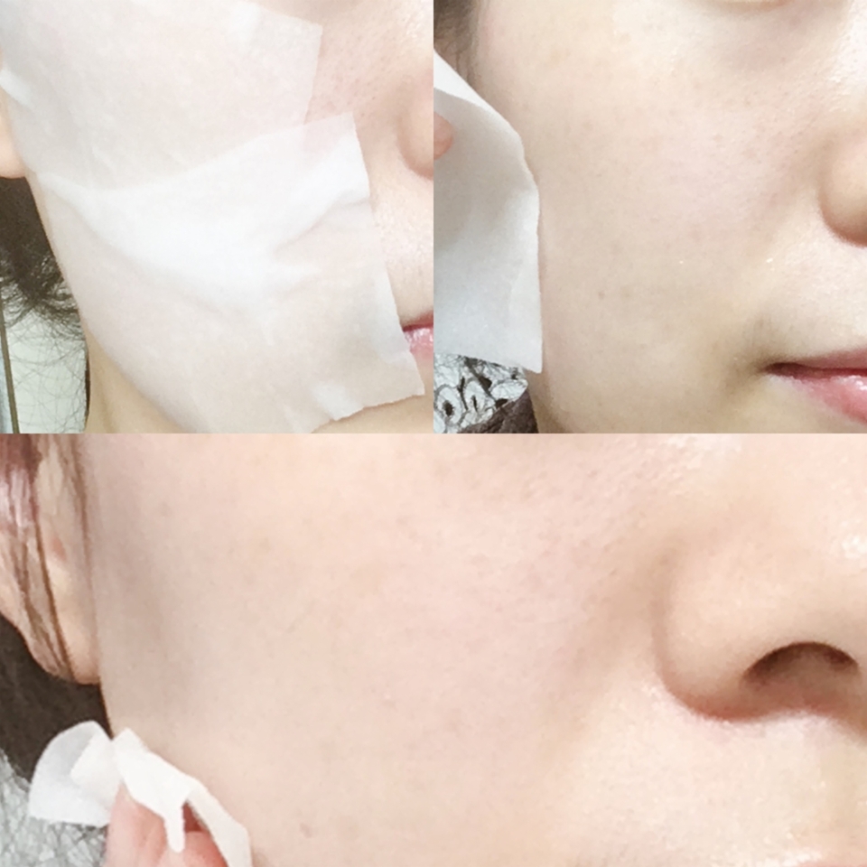  보편적인 팩의 권장시간 동안 사용하는 것처럼 사용해주시면 되는데요, 보통 10-15분 정도가 가장 적당해요! 저는 시중의 마스크팩을 사용하면, 종종 뒤집어지거나 되려 피부가 답답해져서 식염수 팩을 사용하곤 하는데요! 제겐 아주 자극도 없고 순해서 추천하고 싶은 방법이에요 ☆

 + 얼굴에 열 오르는 것이 가장 고민이라면?
냉장보관을 살짝 해주고 부착해주세요! 그러면 피부의 열을 더 빠르게 떨어뜨려준답니다!