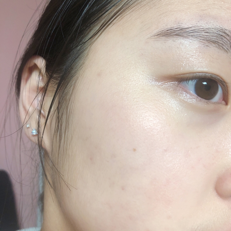 독도토너를 바르고 난 후의 사진!
확실하게 느껴지는 건 바르기 전보다 광이 나고 촉촉해진 피부를 확인할 수 있어요
보습감도 딱 적절하구요 민감성인 제가 사용해도 끄덕없고 진짜 너무 순해서 좋아요
기대하던만큼 정말 좋은 토너라서 이거 다 쓰고 또 사고싶어지네용 ㅋㅋㅋㅋㅋㅋㅋ