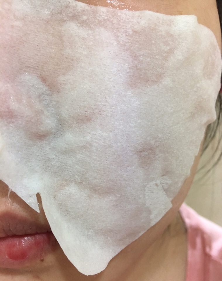 결국 숨쉬기 불편해서 콧구멍 부분은 잘라버렸어요 
밀착력이 왜이러지 싶어서 꾹꾹 눌러보니까 밀착이 안된게 아니라 시트 안에는 탄산거품이 가득 차있는 상태였어요  
팩을 하면서 원래 이렇게 손가락으로 툭툭 두들겨서 사용하는 거라고 하네요 
무엇보다 탄산이 터질때 피부가 따끔따끔 거리면서 아파요 
사용 전 여러 리뷰들을 참고하고 나서 사용하는거라 아프다는건 이미 알고는 있었지만 정말 따가워요! 🤕
냄새도 꼬랑내 나고 사용감도 불편하고 아프기까지 해서 여기까지 정말 불만이 이만저만이 아니었어요 
많이 자극적이라 피부가 예민한 언니들 에게는 추천을 못하겠네요 
