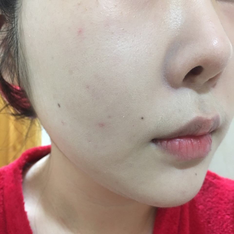 퍼프로 얇게 발라줬어요 
커버력은 그렇게 좋은편은 아니에요
보송하게 마무리되서 여름에 사용하기 정말 좋고 롱래스팅 기능이 있어서 지속력이 정말 좋아요
세미매트 타입이라 그런지 사알짝 알콜향이 느껴져요 
이건 화장 막 끝냈을때 보다 오후가 가장 예쁜것 같아요 무너지는게 예쁘게 무너지거든요!! 
하지만 각질정리를 제대로 하지 않고 사용하면 제 사진처럼 각질부각이 되서 각질 잘 정리하며 사용해야 더 예쁘게 표현돼요 
사용한지 한달도 안되었는데 깨뜨려서 정말 속상하지만 여름에는 P-01컬러를 사용해 봐야겠어요 