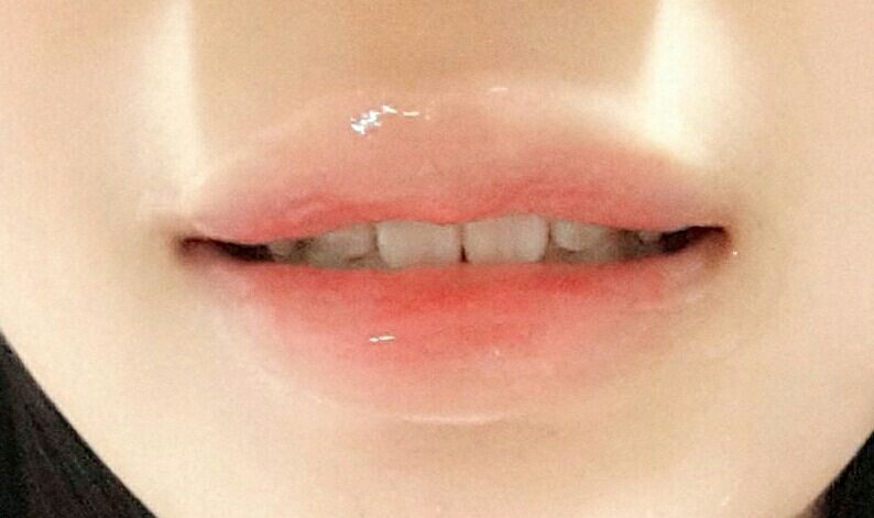 이렇게 수딩젤을 듬뿍 발랐다가 5분 후에 휴지로 톡톡 두드리면서 닦아주시면 촉촉한 입술이 됩니다:)