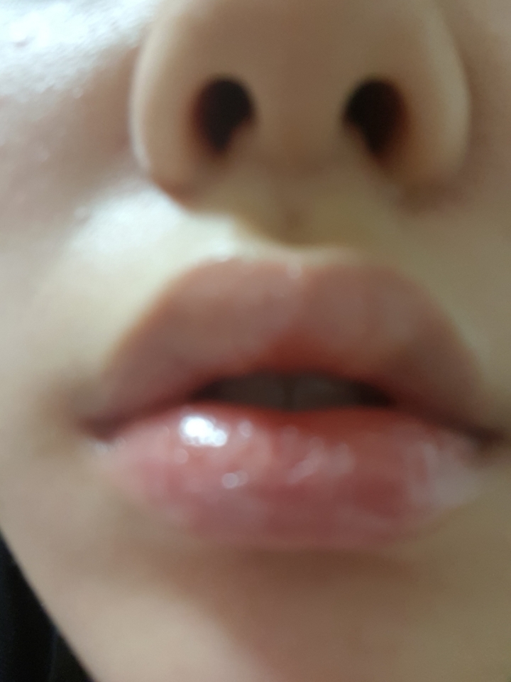 자기전 입술에 바세린을 발랐다보다 올렸다는 느낌으로 얹어줍니다. 새끼손톱정도

일어난후 수건에 물을 뭍혀 살살 딱아내면서 밀어줍니다. 피가 안나게 조심히

그러면 각질제거 왕룡
