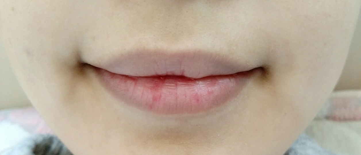 제 맨입술 이예요 
건조해진 날씨에 각질 때문에 입술을 자주
뜯었더니 여기저기 상처 난 자국이 있어요ㅠㅠ