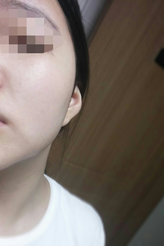 약10분간 붙여주었습니다! 확실이 전보다 촉촉하고 윤기가 도네요!  붙이고 때서 얼굴 전체를 쓸어줬는데 양이 충분했어요~아까워서 어떻게 써ㅠㅜ메이크업 부스터 겸용이라 진짜 화장잘먹을것같은 느낌도납니다💕중요한 날 찾게될 것 같은 느낌(?)
  

 


언파 좋은이벤트 항상 고마워요~🌹💕