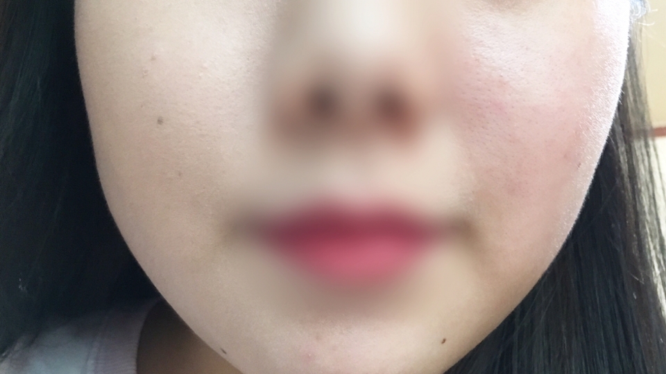 VDL 엑스퍼트 퍼펙트 핏 파운데이션에는 에어 포어 파우더가 들어있다고 하는데요, 요게 피부에 녹아들면서 덧발라도 들뜸 없는 밀착력을 완성시켜준대요!!

바르고 난 뒤 피부가 딱 보송해지고 사진처럼 홍조, 번들거림 모두 잡아주는 게 아주 효자템이더라구요~~?!
(((24시간 커버지속력 소비자테스트를 통과해서 그런가봐요)))