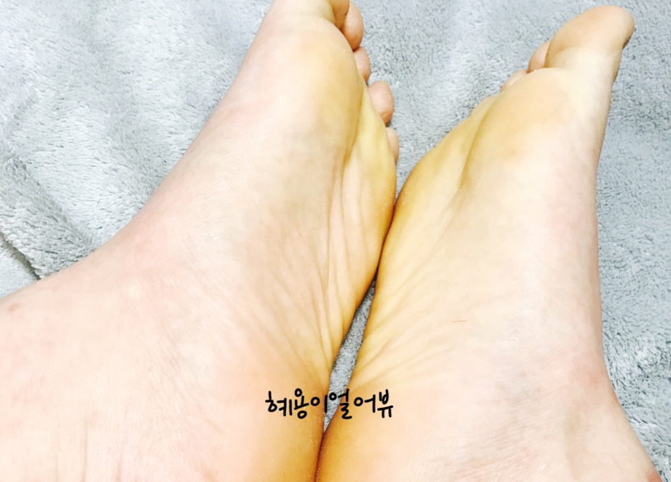 7일차에 찍은 사진이에요!
세상깔끔....! 오랜 발각질 과의 전쟁 통을 이겨내니,
예쁜 아가발로 부활했습니다! ↖ ^ㅁ^ ↗
여러분 진ㅉㅏ 효과는... ㄴ짱이에여... 걍 짱....★
발각질 고민이신분... 굳은살 고민이신분... 이거 사세여...
