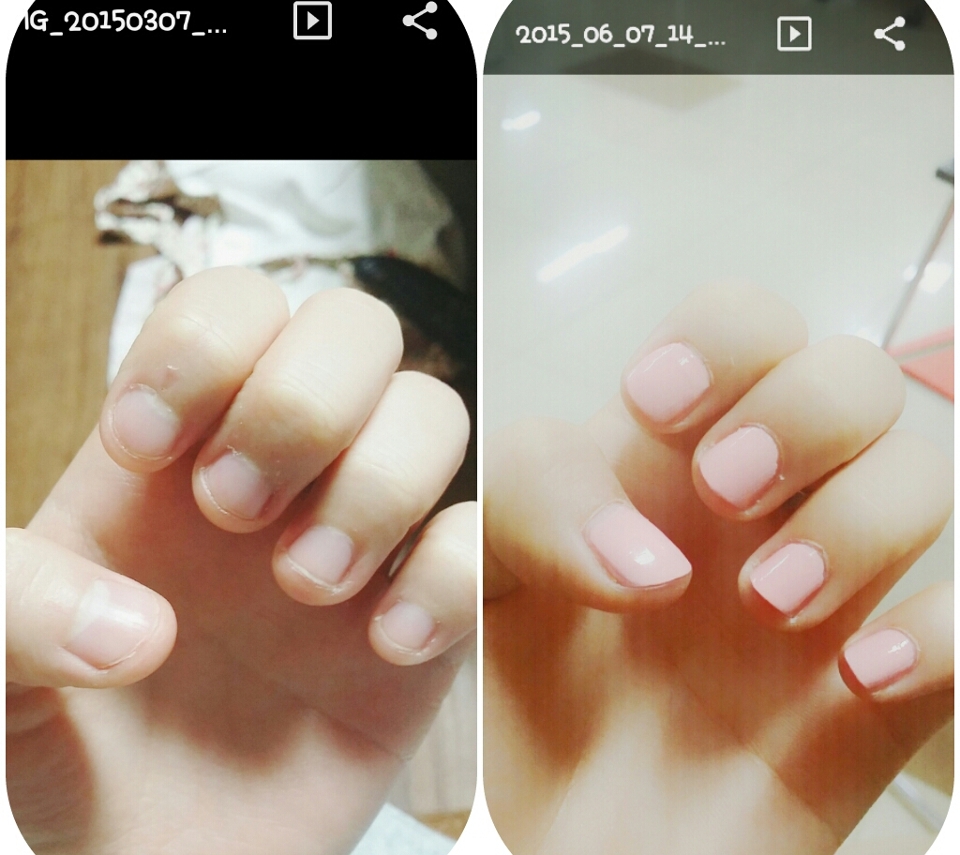 3개월간 변화에요ㅎㅎ
많이 예뻐졌죠.
앞으로도 잘 관리해보려고 해요.

저처럼 물어뜯고 계신 분들!!! 저랑 같이 고쳐나가봐요!ㅎㅎㅎ 헤헿

읽어쥬셔서 감사하구 질문있으시면 댓글남겨주세요!!♡