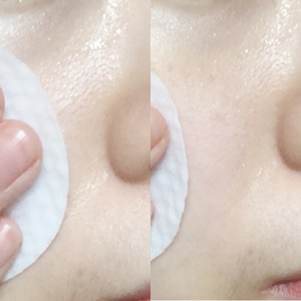  깨끗하게 세안하고 난 상태에서 가장 먼저 사용하는 기초 제품은 '셀퓨전씨의 트리악 모공패드'에요. 언파박스를 통해서 접했던 패드인데, 이거 피부를 잘 닦아주는 엠보면의 패드이면서 수분감이 가득해서 이번 뷰티팁에 넣어봤어요! 실제로 제가 거의 주3회 가량은 애용하는 것 같아요 (이유? 매일 닦아내는 기초를 하는건 피부 자극을 줄 수도 있을 것 같아서요ㅠㅠ)

 패드가 약간 도톰하게도 느껴져서 닦아내도 패드의 모양 변형이 없었어요. 그리고 완전 수분 가득이라 피부를 세게 닦지 않는한은 별 자극도 없었구요. 완전 수분 부족타입 분들이 가볍게 쓰기 딱 좋아요! 