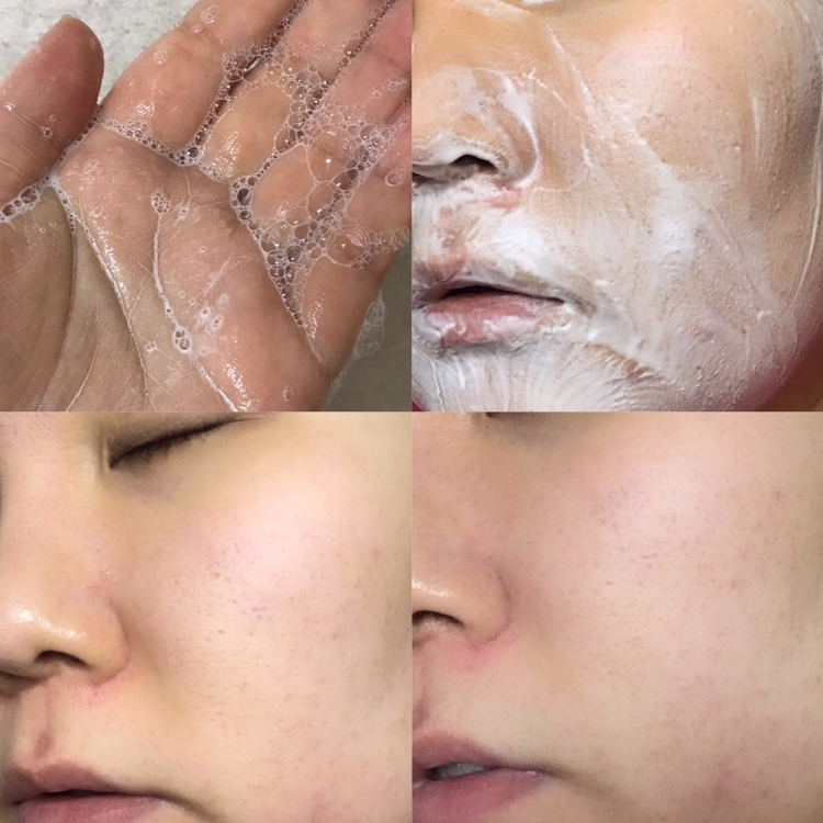 생크림같은 제형에 거품도 엄청 잘나고
깨끗하게 클렌징됩니다 !!
사용후 건조함도 거의없고 피부가 쫀쫀해져서
화장도 잘먹더라구요💕

저는 지성피부인데 아침에도 클렌징폼을 써주는데,
밤사이 나온 기름, 유분때문에 아침에도
꼭 클렌징폼을 사용해주는데 대신 순한제품위주로
써주는데 그중 하나가 브링그린제품이예요 !!

아침에 쓰기에 순하고 세정력도 괜찮아서
작년부터 꾸준히 쓰고 있어요 
민감성피부분들에게 적극추천합니다 👍🏻