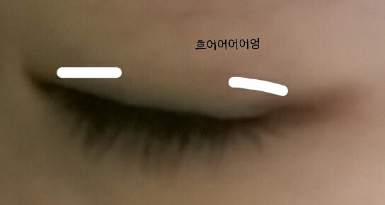 하양색으로 된부분에 쌍액을 해주세요😀😀