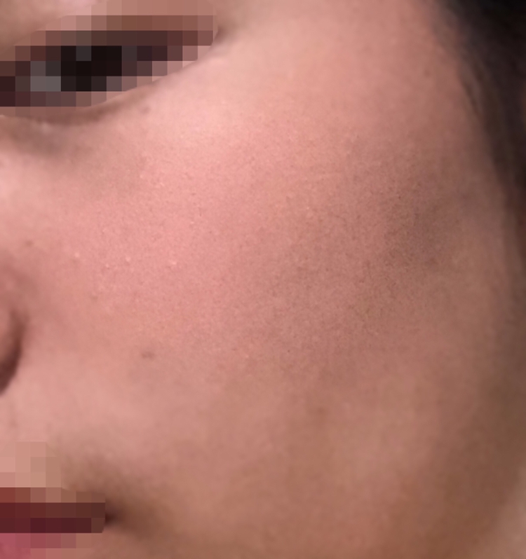 진짜 엄청 많이 발랐는데도 카메라에 안담아지더라고요ㅠㅠㅠㅠ. 진짜 뽀샤시하게 볼에 올라가고 피치보다는 살구같다는 느낌이 들었습니다❗️❗️
좀 흔한색이긴 한데.. 뽀샤시하게 올라가고 자연스럽게여리여리한 느낌을 내줘서 잘 바르고 있어요💕💕


그럼 안녕안녕어어엉🙌🏻🙌🏻🙌🏻🙌🏻