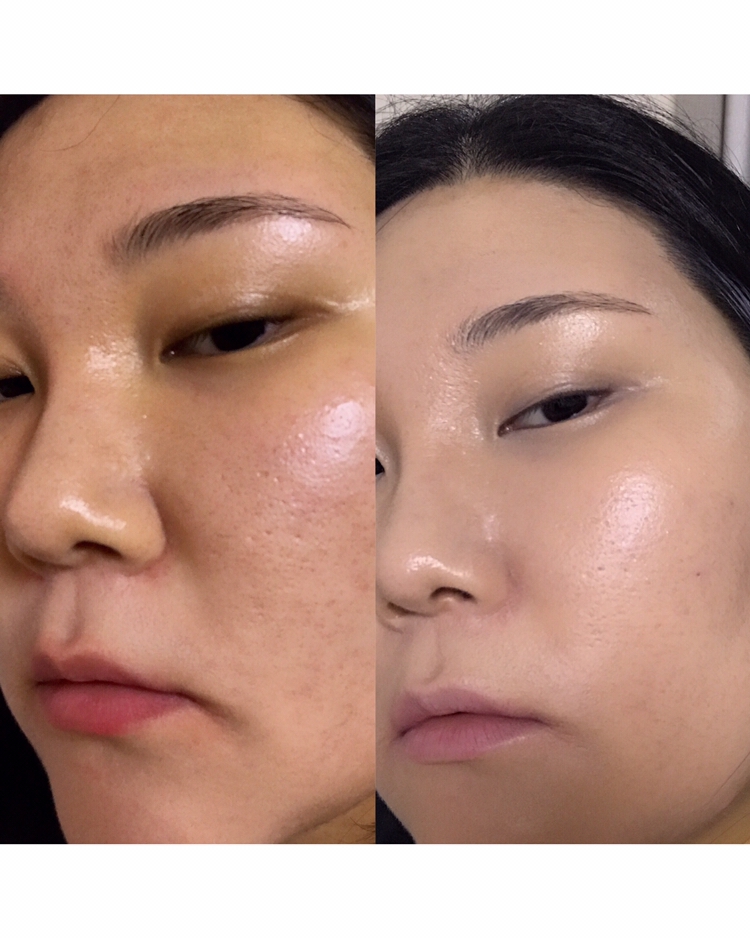 저는 22호인데 화사하게 꾸미고 싶을때,
21호쿠션을 발라주는데 어떤쿠션은 얼굴이 동동 뜨는감이 있는데 이자녹스쿠션은 자연스럽게 톤업되면서 얼굴을 화사하게 표현해줍니다 !!

얼굴이 전체적으로 노란끼가 많이 도는편인데
잡티와 모공들도 프라이머를 안발라도
어느정도는 커버해줘서 너무 만족합니다 !!
그리고 지속력도 좋은편이라서 여름에
사용해도 무관합니다 👍🏻
