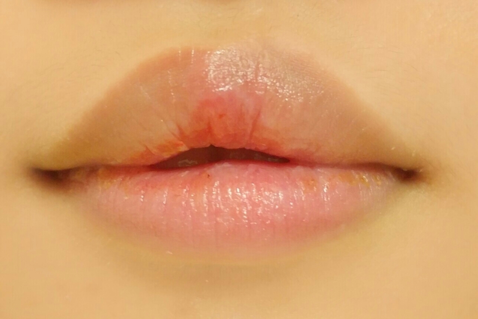 1.입술에 바세린 적당량을 5분동안발라두기 

매트립,글로시립 바르기힘드시죵?ㅠㅠ 손재주나 도구때문이아닌 바로 !!입술에 각질때문에 이쁘게발리지 못하는겁니당!!
각질있으면 어떤앵두같은입술이라도 이쁘지못할께같아용ㅠㅠ