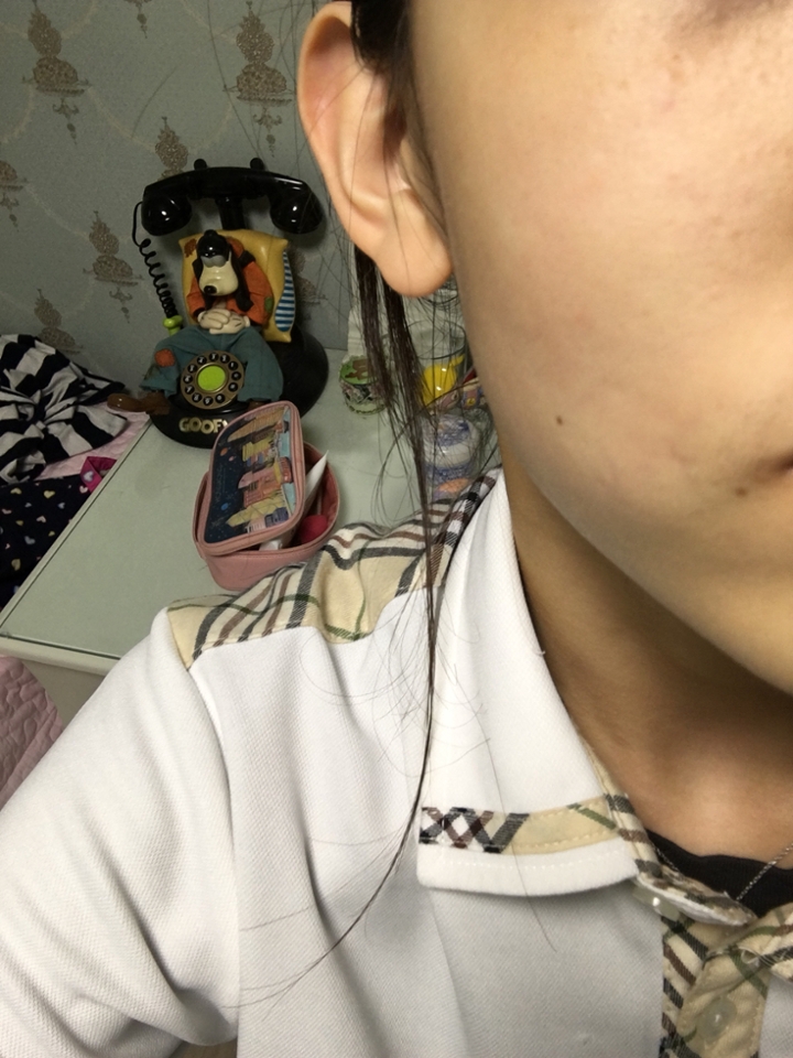 불쌍한 피부 이건 안바른쪽