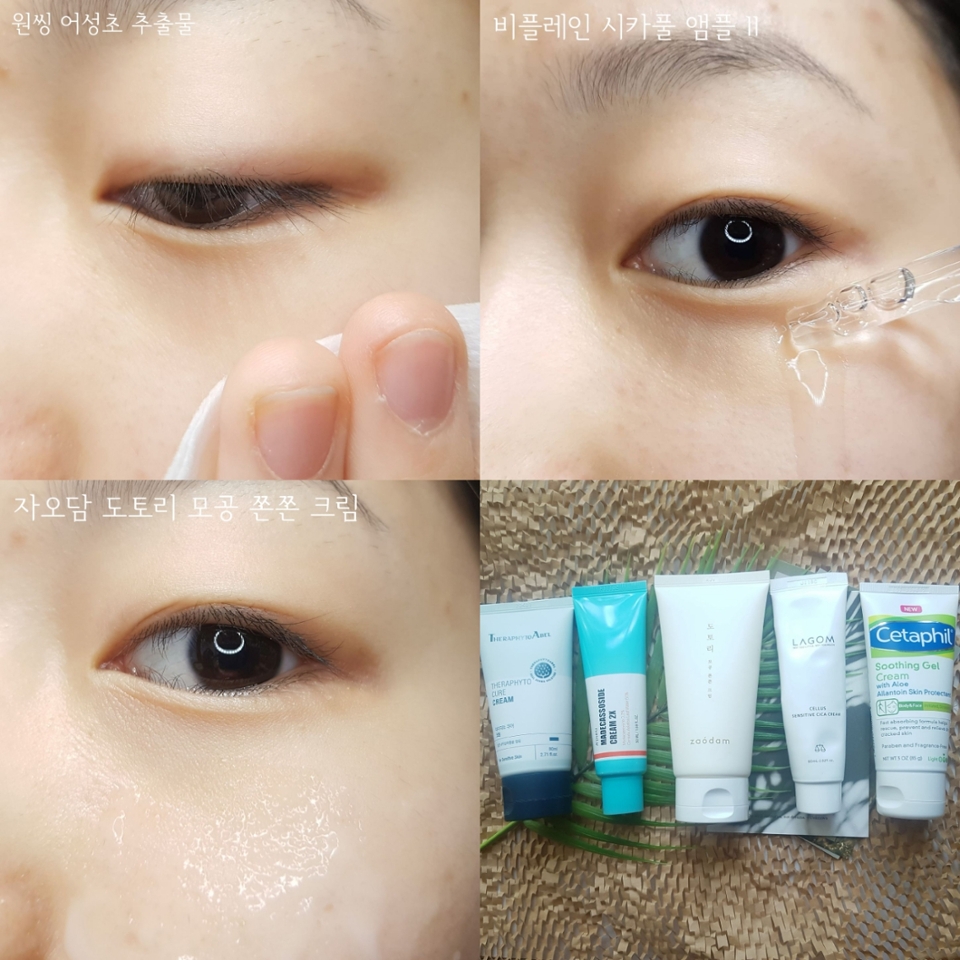 요거는 지성분들께 추천드리고픈 조합이에요!
촉촉+산뜻+(살짝)보습+진정 조합입니다ㅎㅎ

•어성초 제품을 미스트 형태로 (혹은 닦토) 충분히 뿌려줍니다.
•비플레인 앰플을 충분히 발라줘서 흡수시켜주세요
•자오담 크림을 듬뿍 발라서 손으로 톡톡 쳐서 흡수시켜줍니다.

마찬가지로 단계를 최소화 해서 간단하게 마무리해줬어요ㅎㅎ
그래도 건조한 부분이 있다면 꾸덕한 제형의 크림으로 부분적으로 보습시켜주면 좋을 것 같아요!
(**테라피토에이벨 테라피토 큐어 크림, 라곰 셀러스 센서티브 시카 크림 추천)