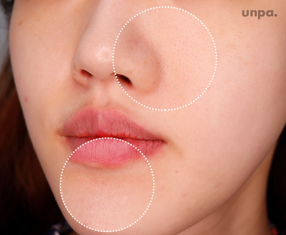 ※적나라함 주의※

참고로 에디터 피부 상태는 이러함 ^^

에디터에게 블랙헤드란
영혼의 동반자나 다름없을 정도로
오랜 시간 함께해 온 존재인데,
그만큼 깊고 오래 묵은 블랙헤드가 많음!